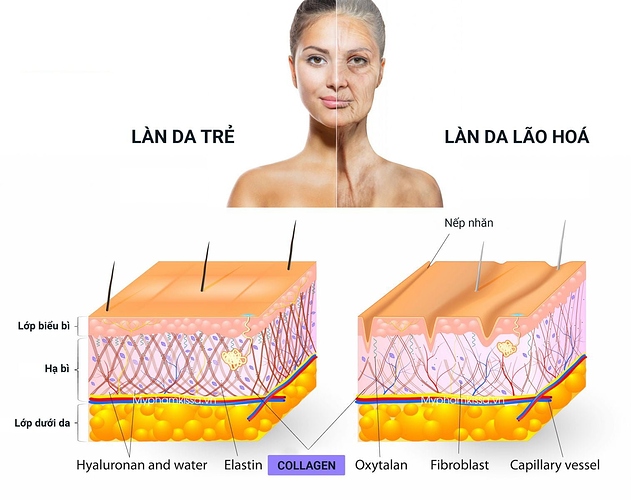 da-thieu-hut-collagen